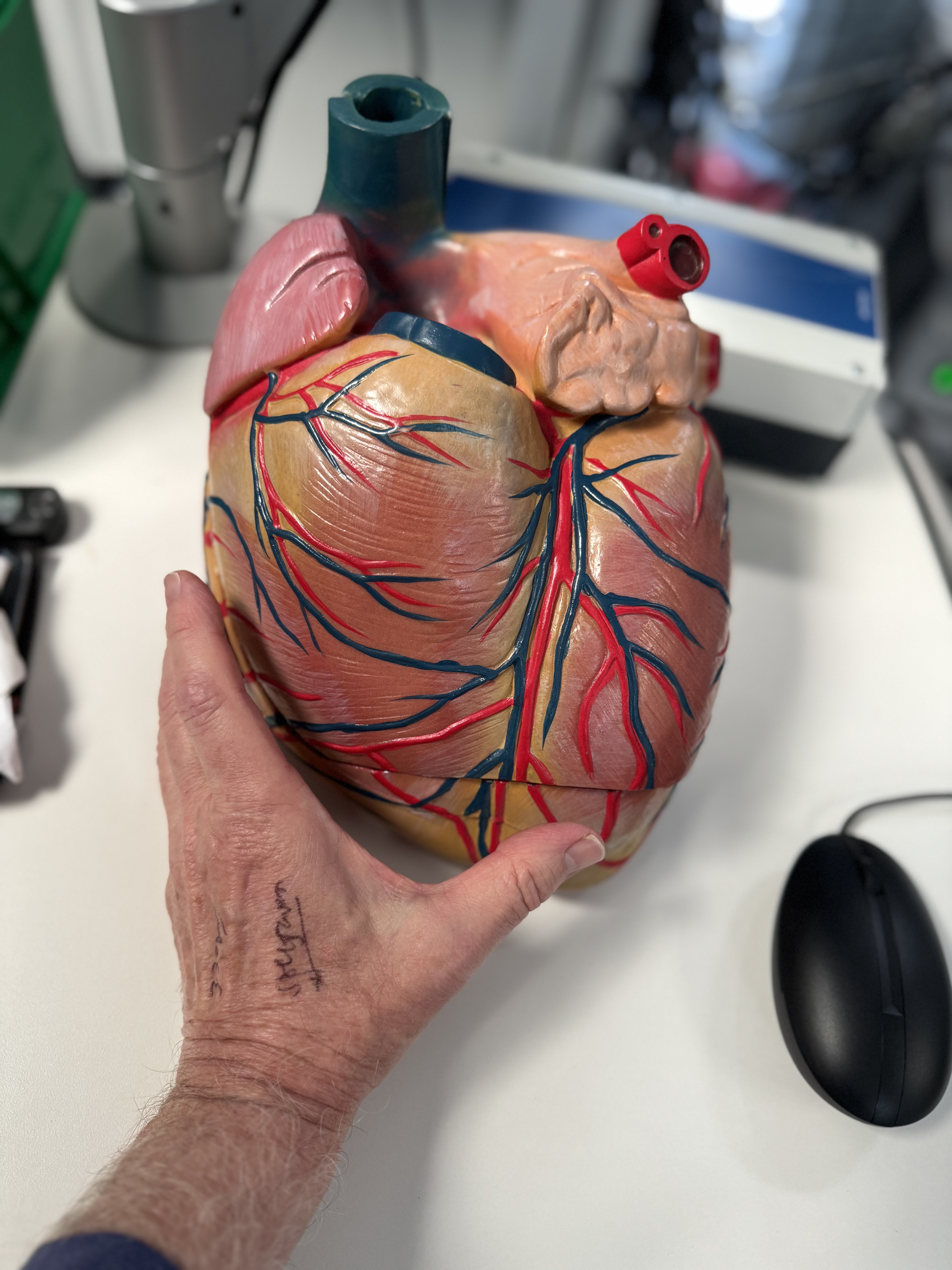 An anatomical model of the heart showing surface vessels.
